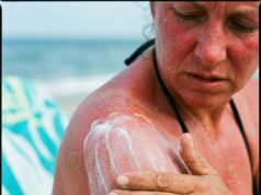 Zonnebrandcrème gevaarlijk? dit zeggen artsen en de wetenschap